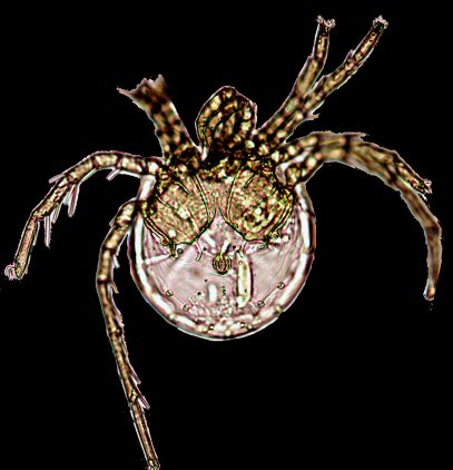 Litarachna lopezae